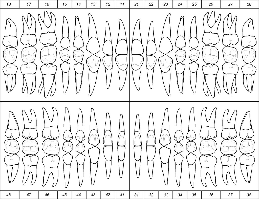 ejemplo de odontograma